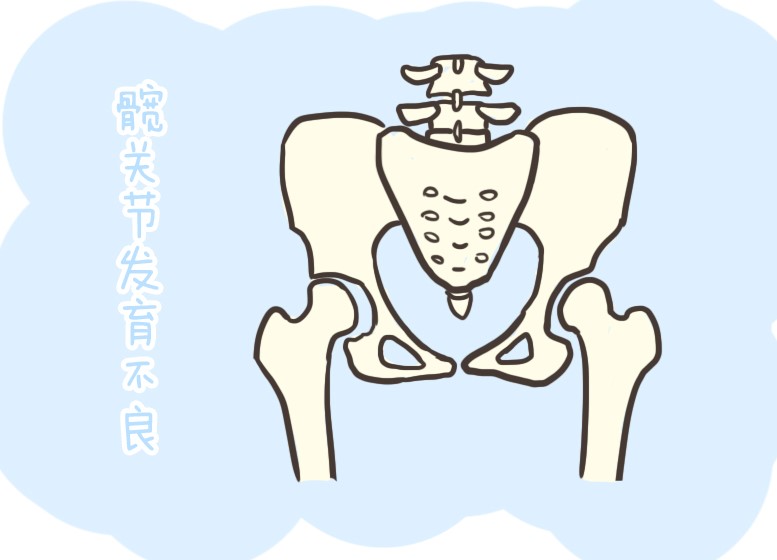 股骨头146.jpg